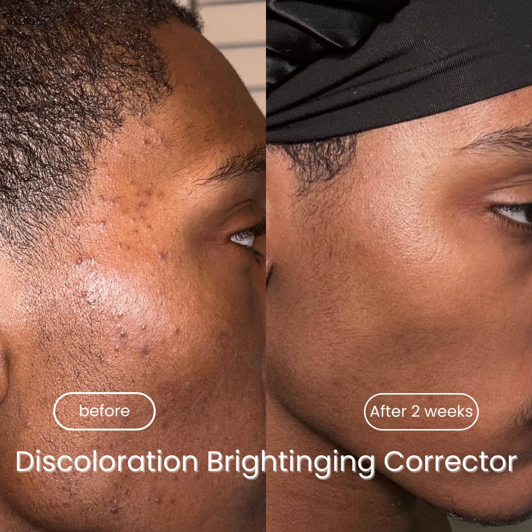 Discoloration Brightening Corrector