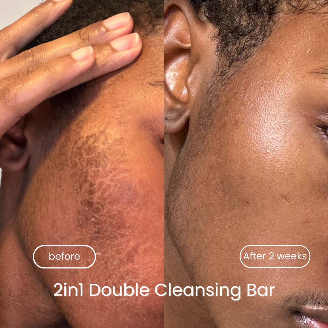 2-1 ACNE & DARK SPOT CORRECTING CLEANSER
