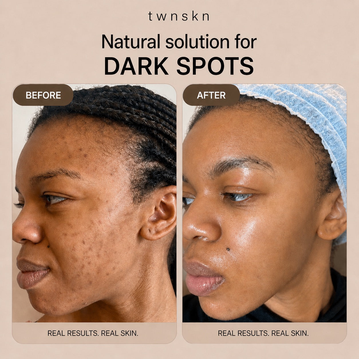 Dark Spot Correcting Serum