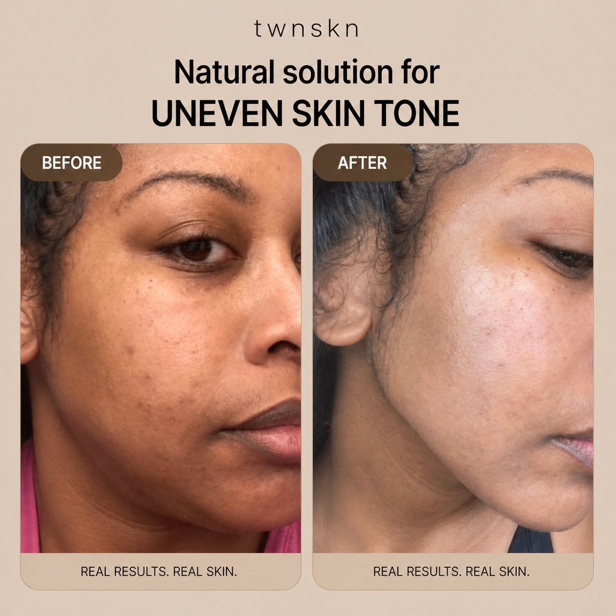 Glass skin kit