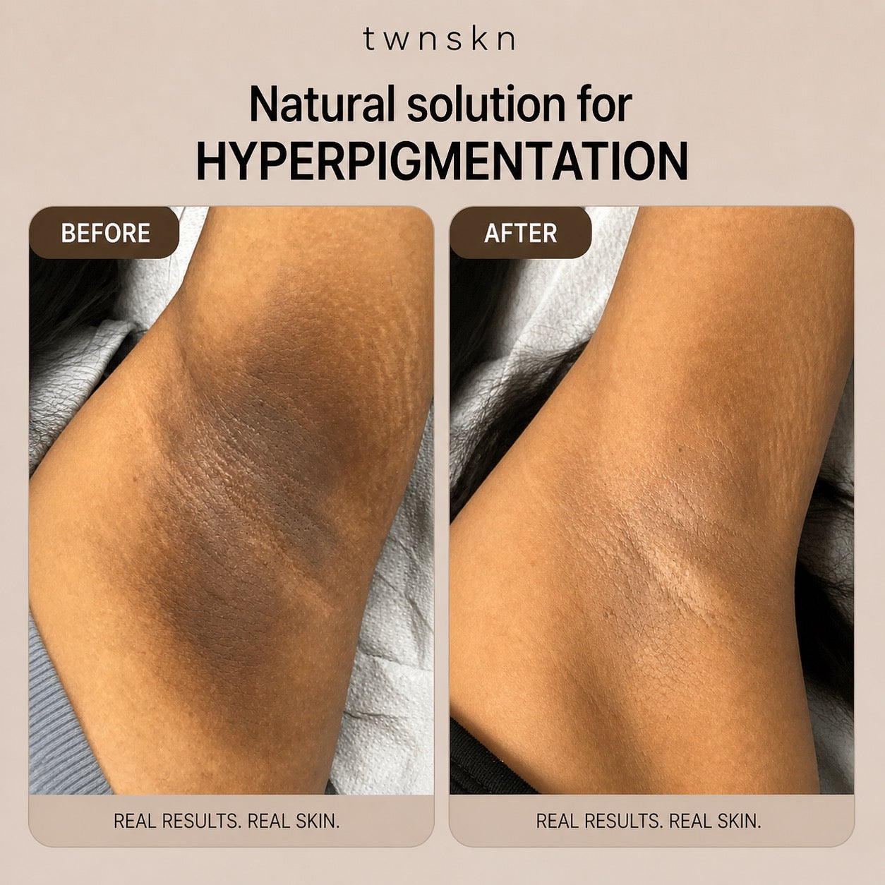 Turmeric Dark Spot Removal Scrub